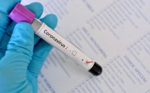 7170 случаев коронавирусной болезни COVID-19 зафиксировано в Украине