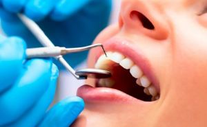 Огляд найсучасніших біоактивних стоматологічних матеріалів