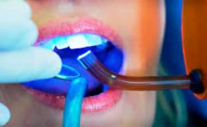 Зубной вопрос. Немецкие стоматологи против постановления Европейского союза о запрете использовать пломбы для зубов, содержащие ртуть.