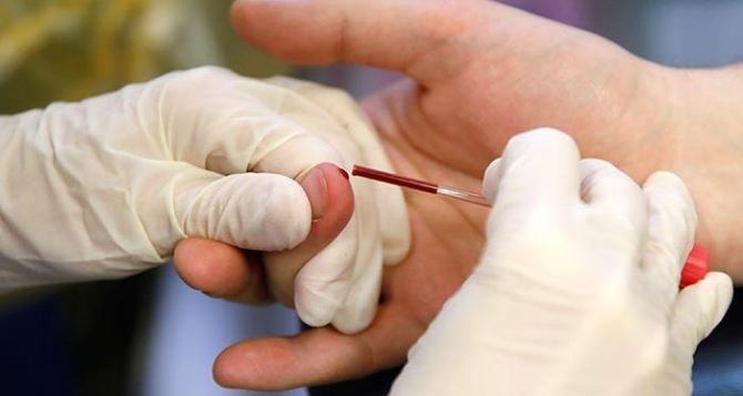 В Луганске обнародовали результаты анализов тех, кто контактировал с первым заболевшим коронавирусом