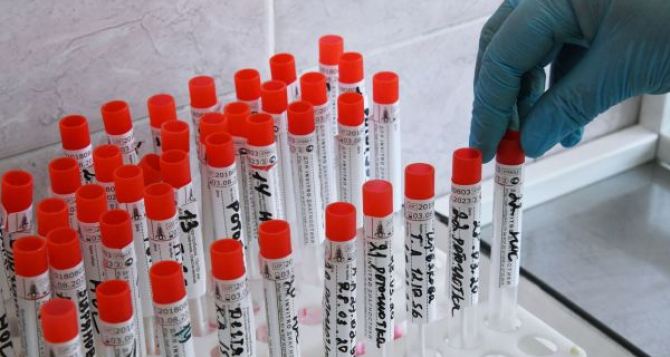 Подтверждены новые случаи коронавируса в Луганской области