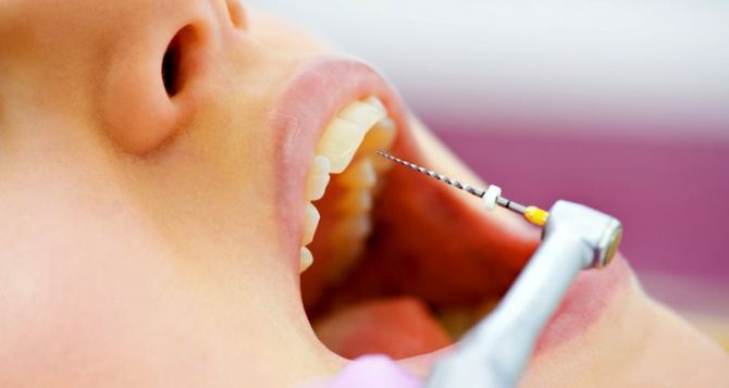 Реставрация зубов: основные способы