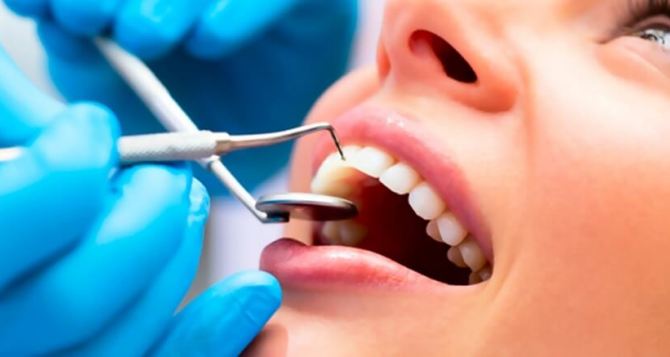 Отбеливание зубов в стоматологии: ответы на вопросы