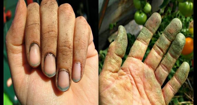 Как восстановить кожу рук после работы в огороде — сухость пройдет моментально