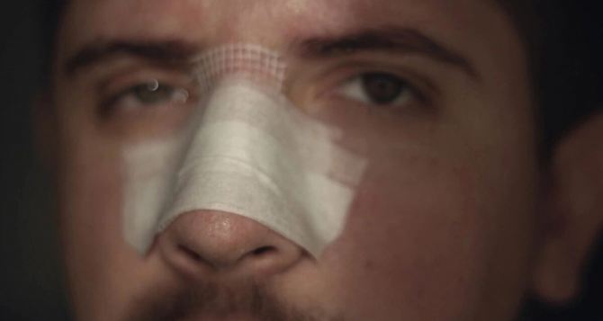 Вместо повестки условный срок В Харьковской области мужчина сломал нос офицеру ТЦК