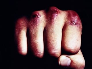 В Лисичанске молодой парень до смерти избил 56-летнего мужчину