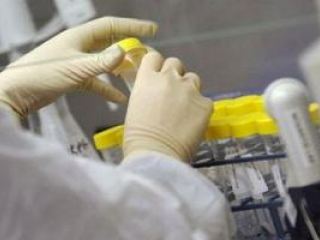 Эпидситуация в Луганской области остается стабильной