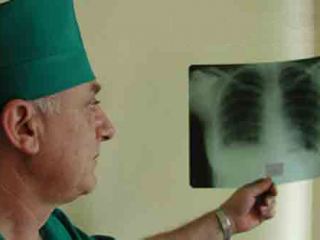 В Алчевске увеличилось количество заболевших туберкулезом