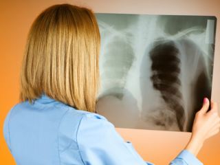 В каких случаях больного туберкулезом заставят лечиться через суд