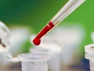 жителей Луганской области страдают от царской болезни