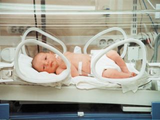 На Луганщине дети все чаще рождаются недоношенными