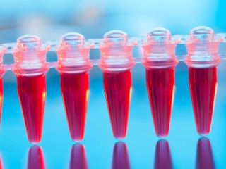 Может ли анализ на ВИЧ/СПИД ошибаться?